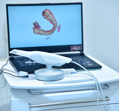 oral scanner